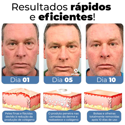OpenEyes - Creme Reparador Rápido de Olhos (Elimina Rugas, Bolsas e Olheiras)