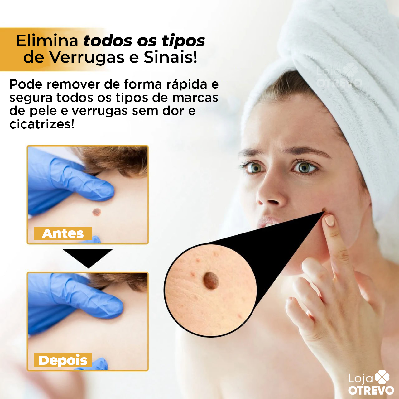 BeeTag - Spray Removedor Instantâneo de Verrugas e Sinais da Pele (EFEITO IMEDIATO)
