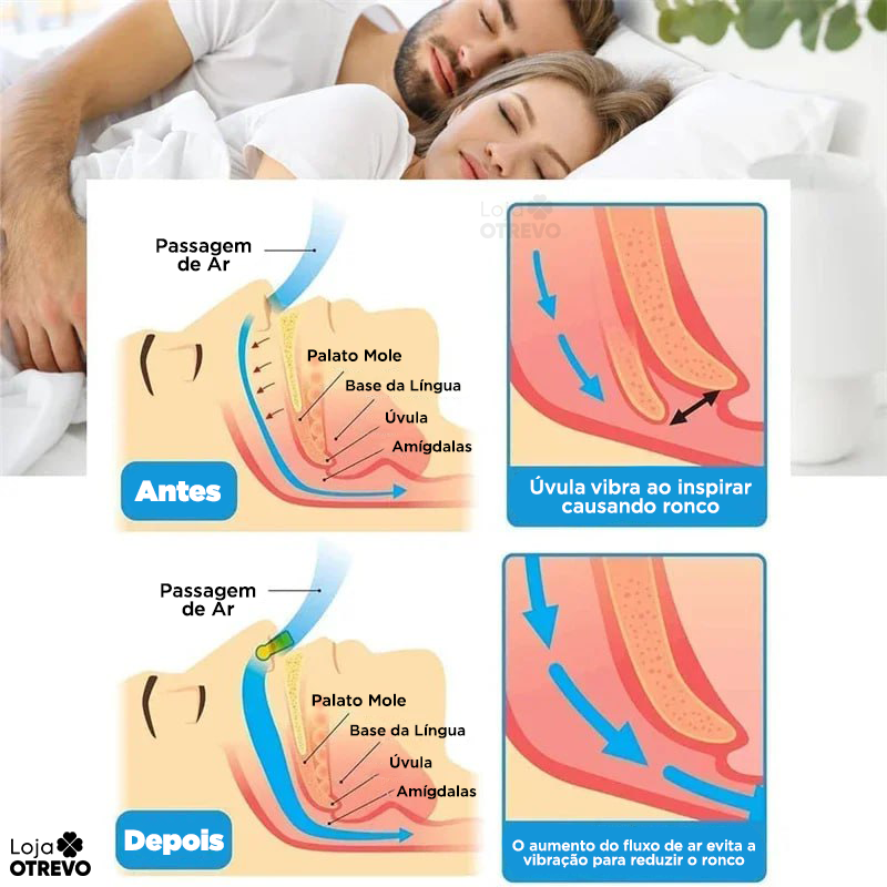 Anti Ronco Magnético - Nasal Flex® (Compre 1 e leve 4)