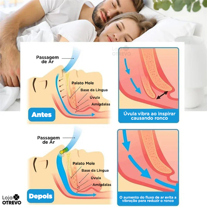 Anti Ronco Magnético - Nasal Flex® (Compre 1 e leve 4)