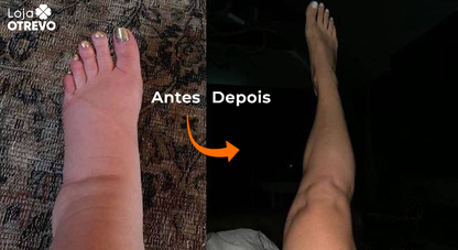 Creme Reparador de Ossos ( Desinflama, Fortalece e Restaura os Ossos) - BoneMax (HONEY BEE)®