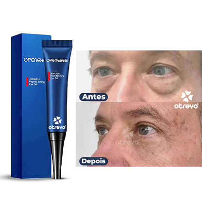 OpenEyes - Creme Reparador Rápido de Olhos (Elimina Rugas, Bolsas e Olheiras)