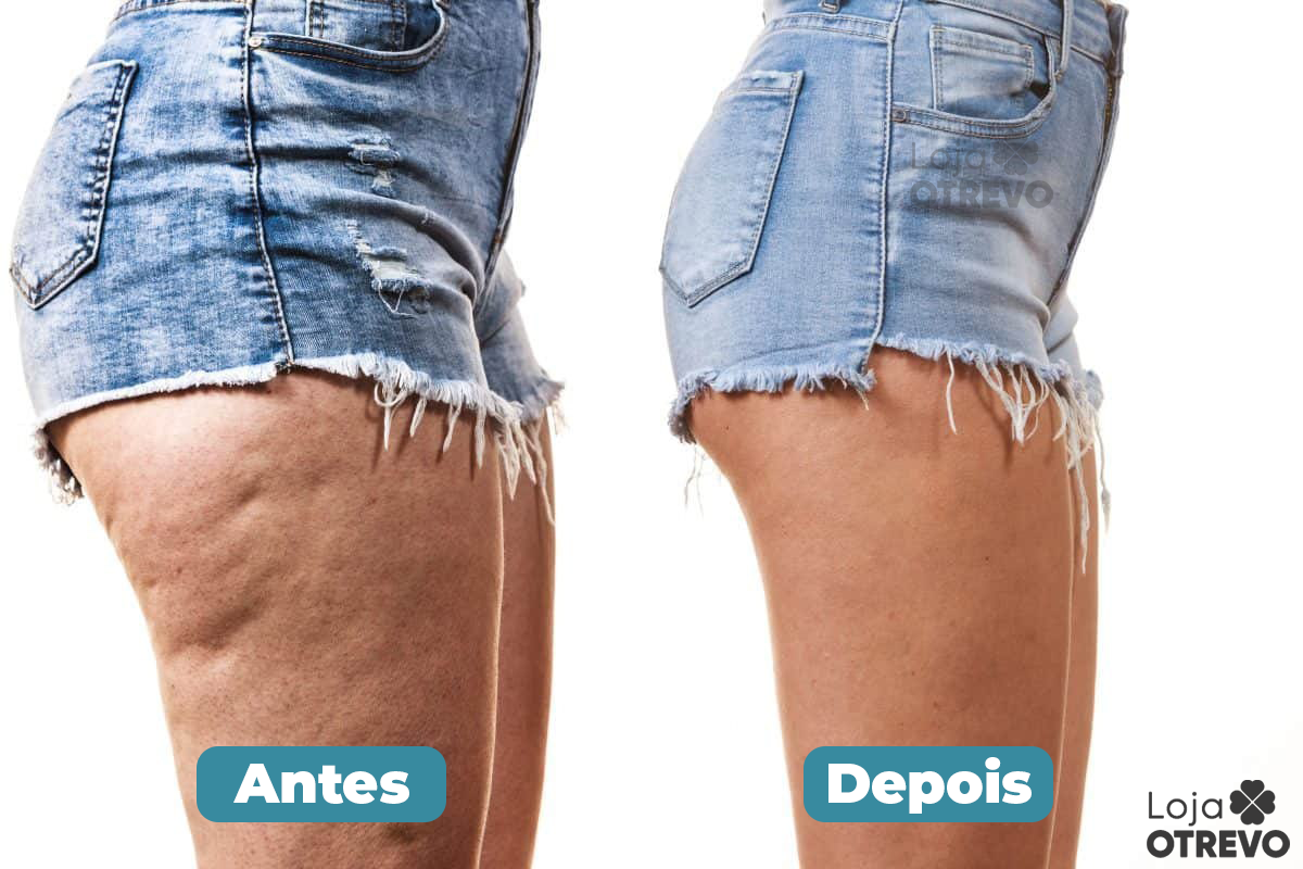 RevitaCell - Creme Removedor Rápido de Celulite e Rugas