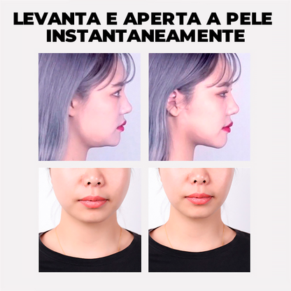 UpFace -  Esticador de Rosto e Redutor de Papada (EFEITO LIFITING INSTANTÂNEO)