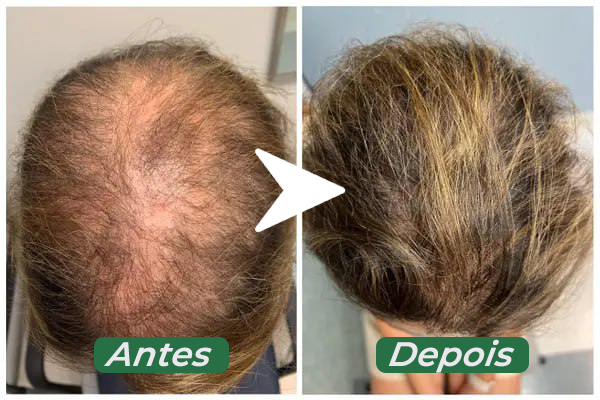 Super Tônico de Crescimento Rápido Capilar (Efeito Rapunzel) 2 em 1  - NutriHair®