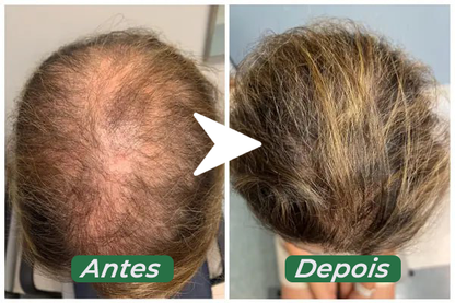 Super Tônico de Crescimento Rápido Capilar (Efeito Rapunzel) 2 em 1  - NutriHair®