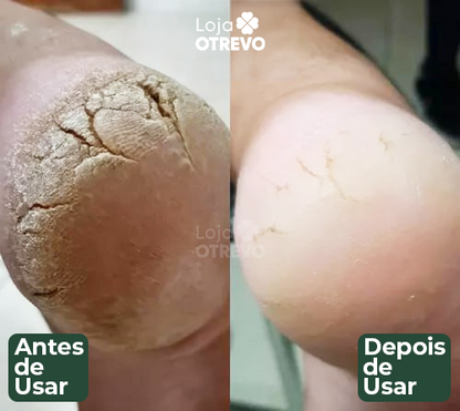 DermaShield - Spray Restaurador Rápido de Pés